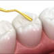 Sealants
